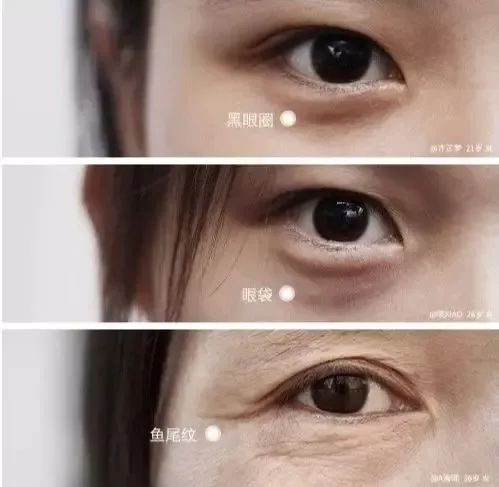 HYBC婳妍丨做好眼部抗衰，轻松把年轻写在年上