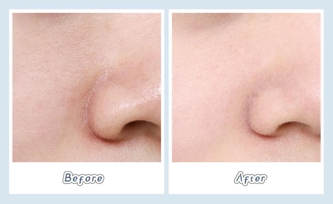 homefacialpro清洁面膜,6款超火清洁面膜测评