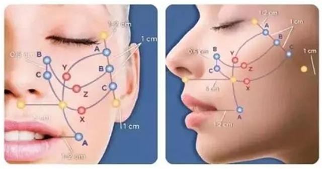 面部线雕跟超声刀哪个好,超声刀线雕和拉皮哪个效果好