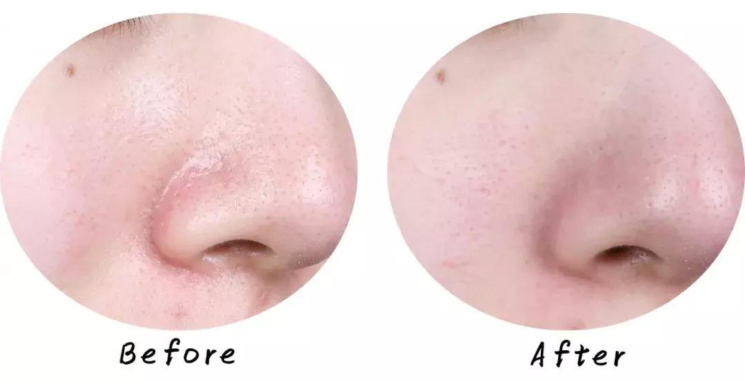 最好用清洁面膜排行榜前十名图片,公认最好用的清洁面膜混油皮