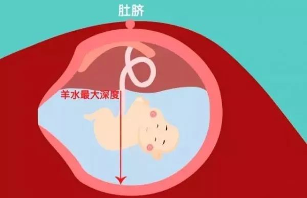 羊水少一招搞定,羊水少了怎么办最快最有效