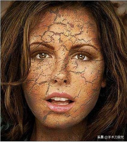 冬季空调房皮肤干燥如何应对,冬天寒冷干燥导致皮肤缺水