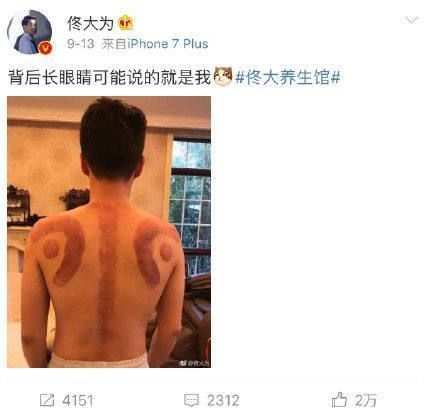 孙俪、佟大为等明星纷纷养生,但关于“养生”的英文你知道多少?