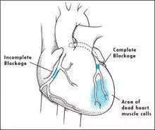 发量减少好不好,发量减小