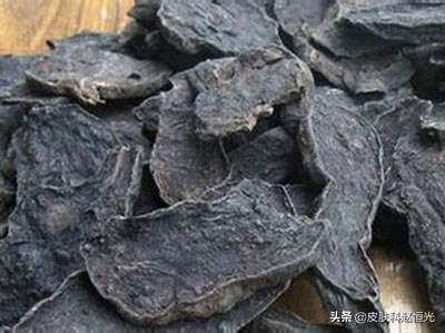 目前治疗脱发最有效的方法,头发油脱发严重怎么治疗才有效