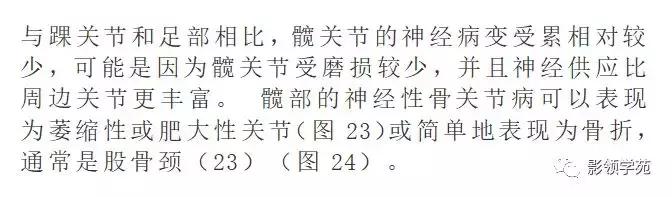 神经性骨关节病,神经性关节炎症状图片