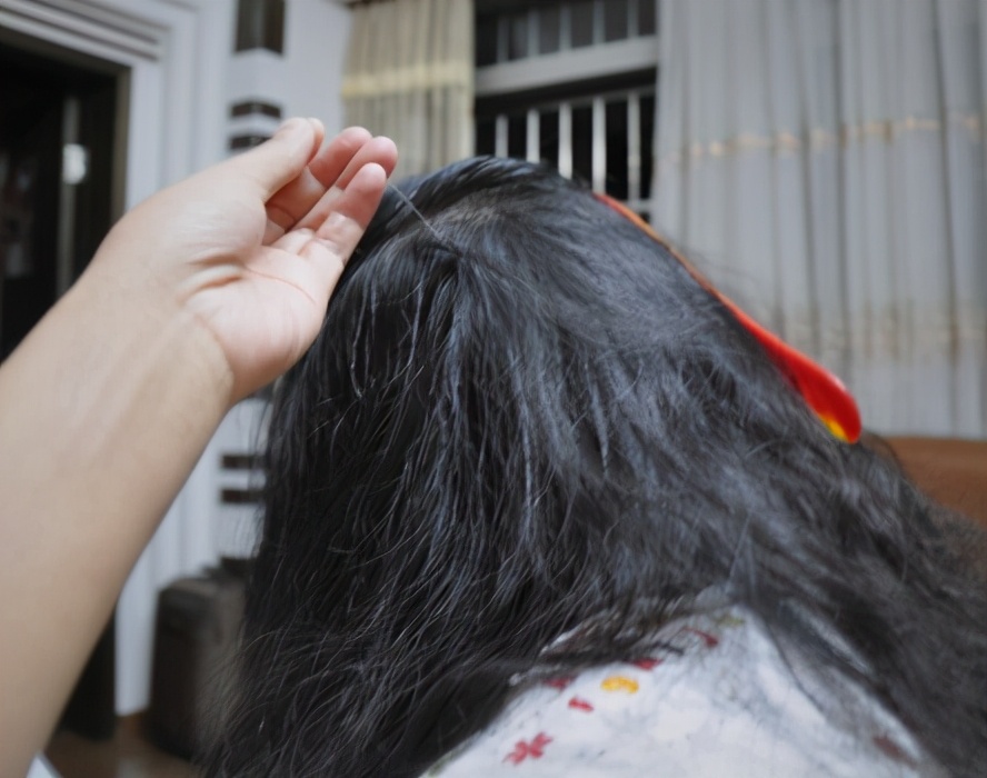 开始长白发吃黑芝麻糊有效吗,少年白发吃黑芝麻丸有效果吗