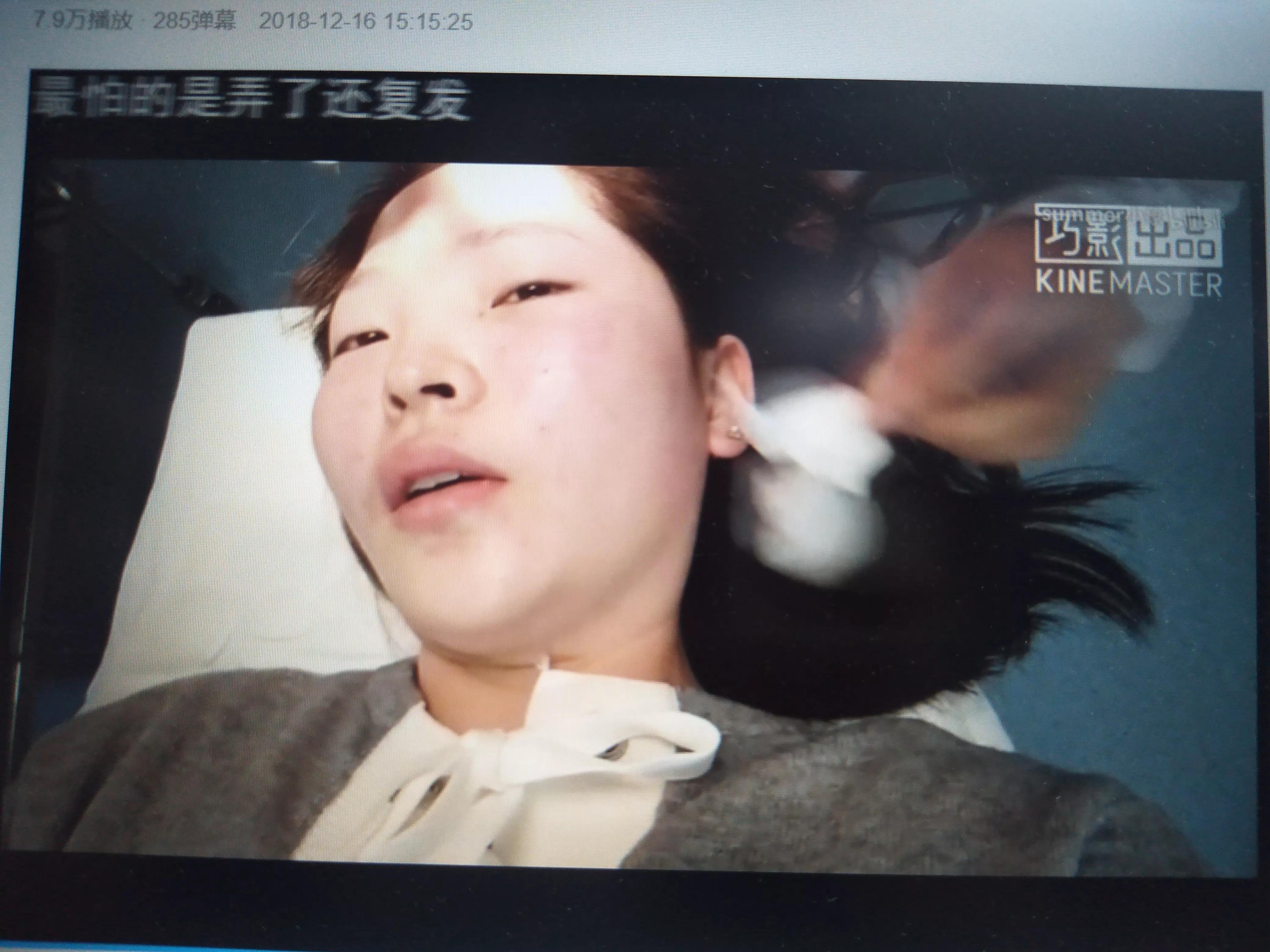 在家怎么把脸上的痣点掉,脸上的痣有毛能不能点掉