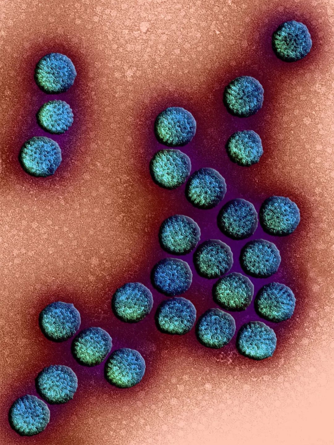 人体防卫战,人体痛点攻击技巧