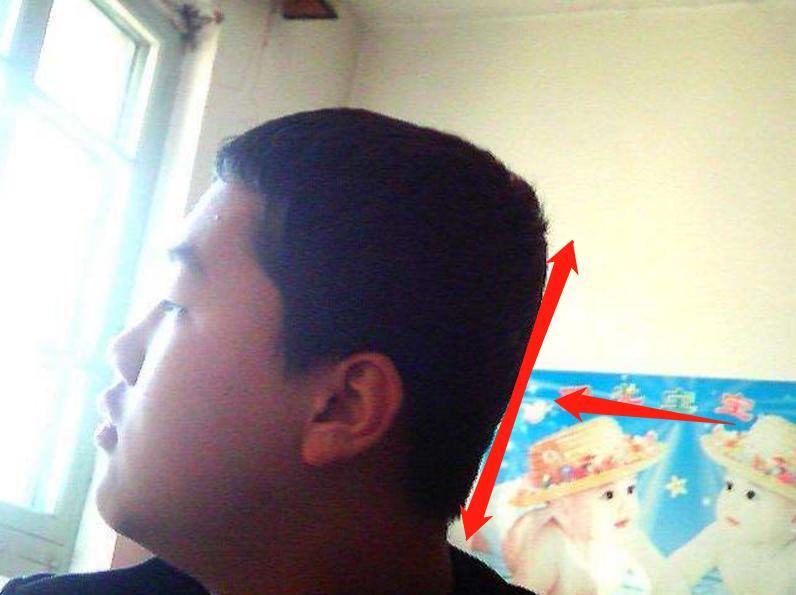 宝宝后脑勺扁的怎么矫正,7个月宝宝后脑勺平怎么补救