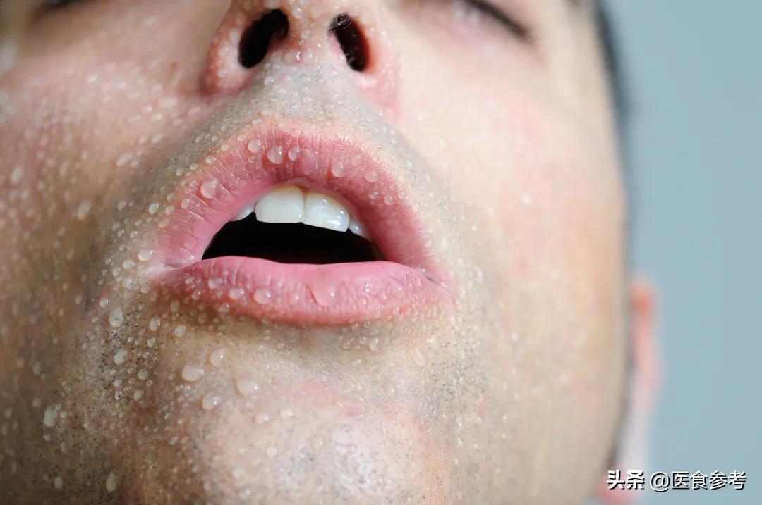 夏日亲热当心“*爱性**感冒”，汗多就是身子虚吗？