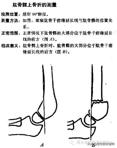 肘关节x线测量,肘关节骨骺示意图
