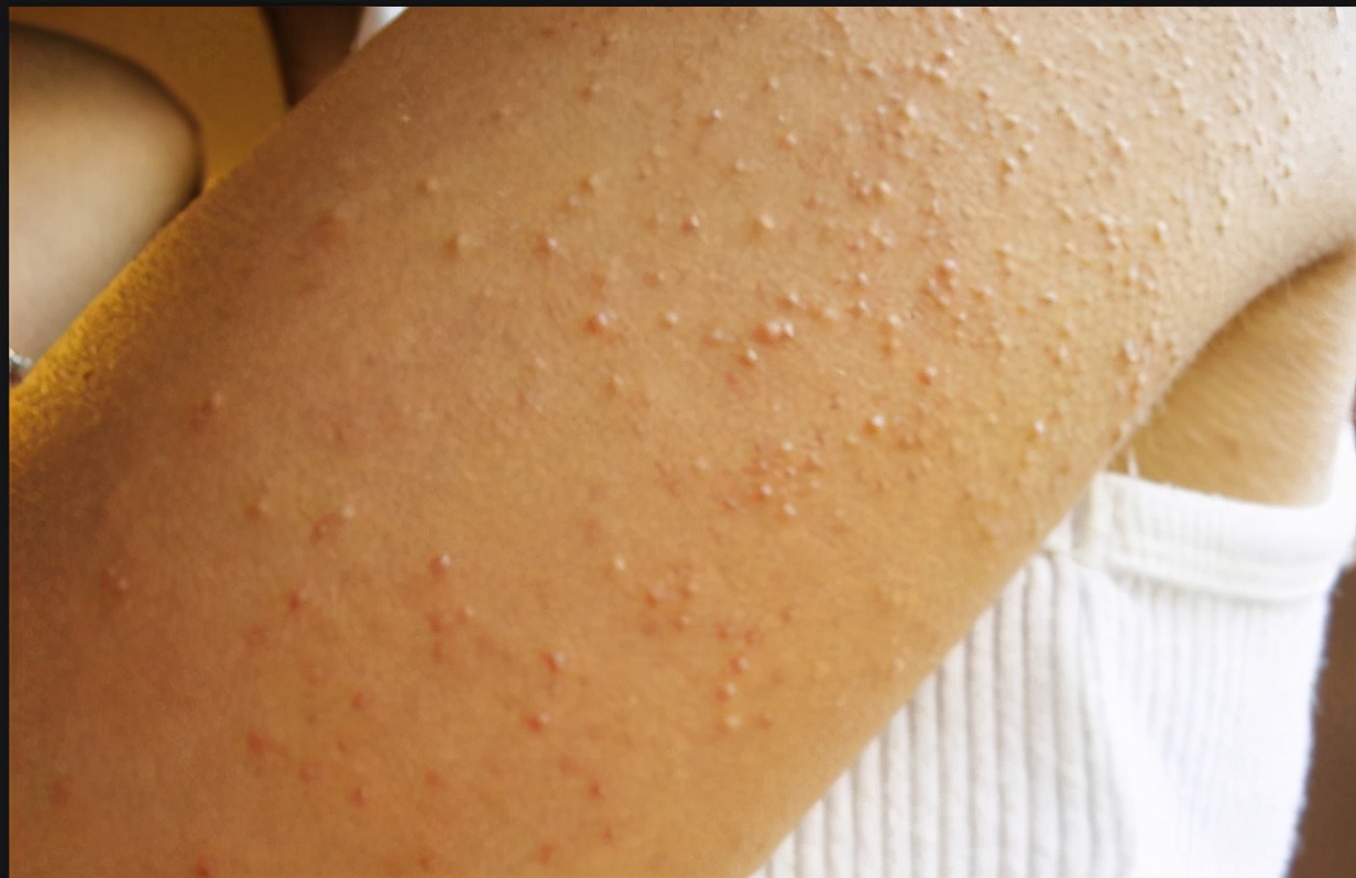 脸部清洁大概要多少钱,如何深层的脸部清洁