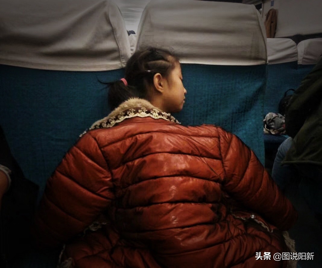 女孩患了200万分之一罕见病,女孩身患罕见怪病