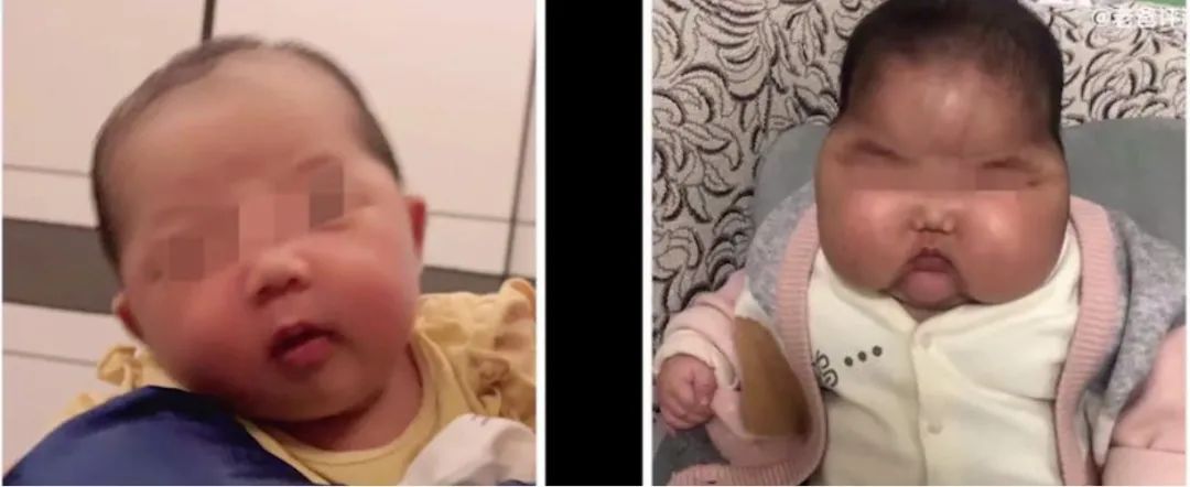 怎么知道孩子是否提前发育,怎么知道孩子提前发育