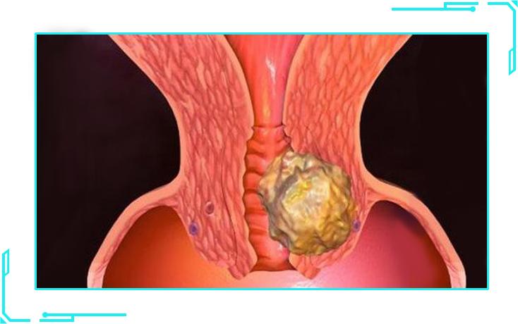 免疫力下降中成药,妇科免疫力下降中药能调理吗
