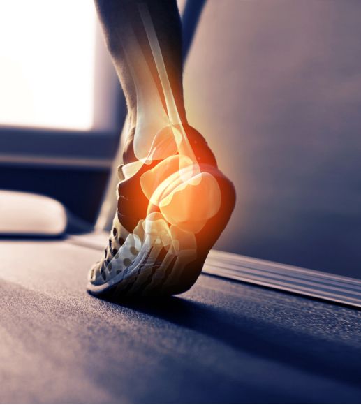 跑步足底痛的防治,足底跑步疼是什么症状