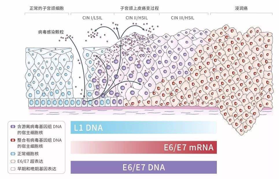hpv核酸检测和e6e7检测有什么区别,hpv筛查和e6e7筛查有什么区别