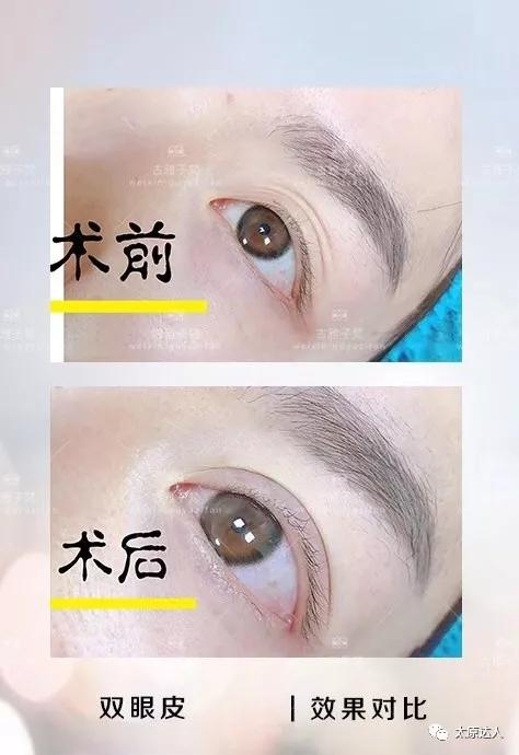 814元人气精华护理免费做！一次就焕颜新生！聚会女王就是你