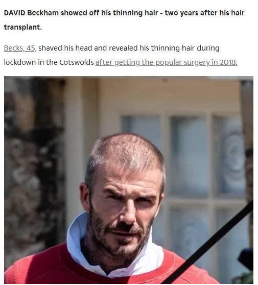 2015全球100帅排名贝克汉姆,贝克汉姆的头发秃了上热搜
