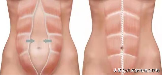 健康科普学这几招缓解产后腰痛,孕晚期突然腰痛厉害是产前征兆吗