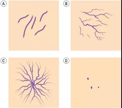 让人羞红脸是什么原因,红脸蛋到底是什么皮肤
