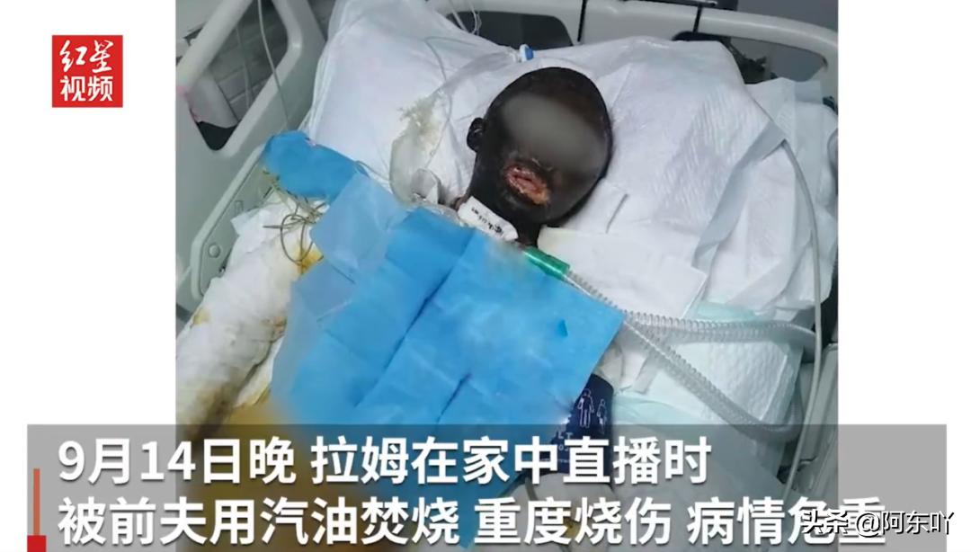 为爱远嫁的女孩被婆婆打,为爱远嫁新疆却遇家暴