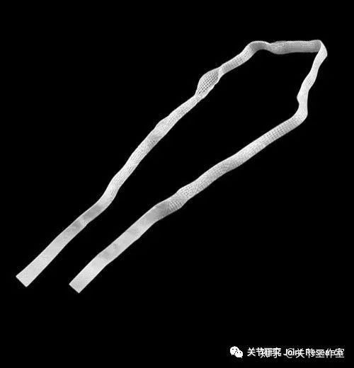 前交叉韧带断裂为什么没评上伤残,前交叉韧带断裂有什么症状