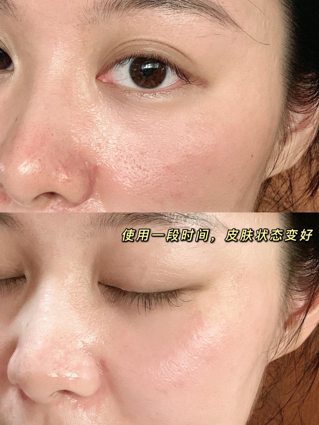 还过儿童节呢?25岁就开始“抗初老”了!这4款别说你一个没用过