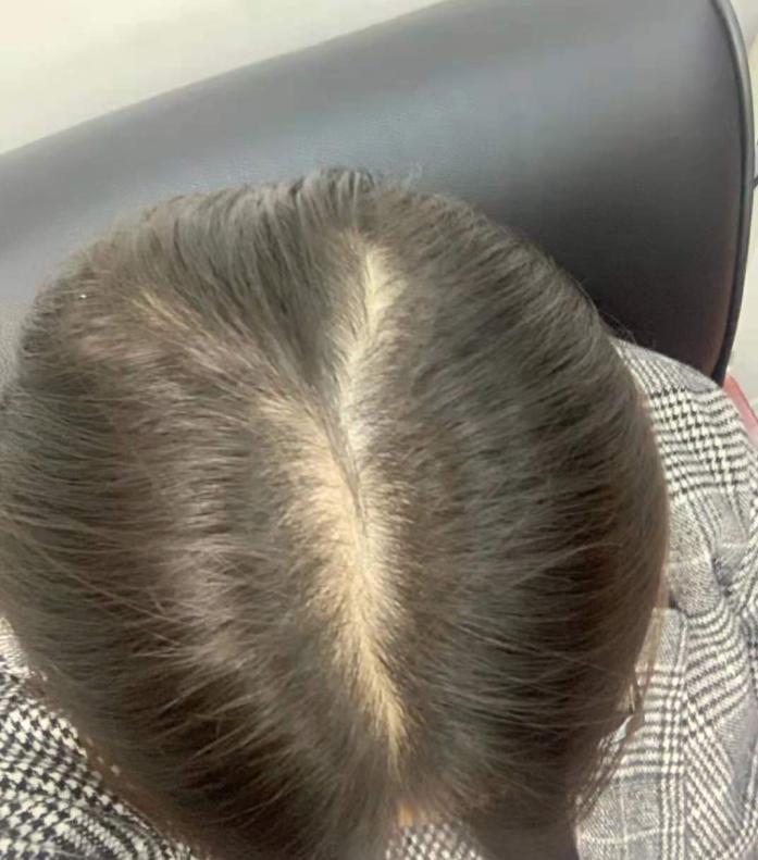 长发飘飘洗发护发,头发越洗越多的洗发方法