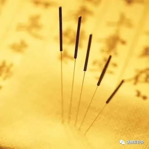 针灸能治疗的疾病居然达数百种