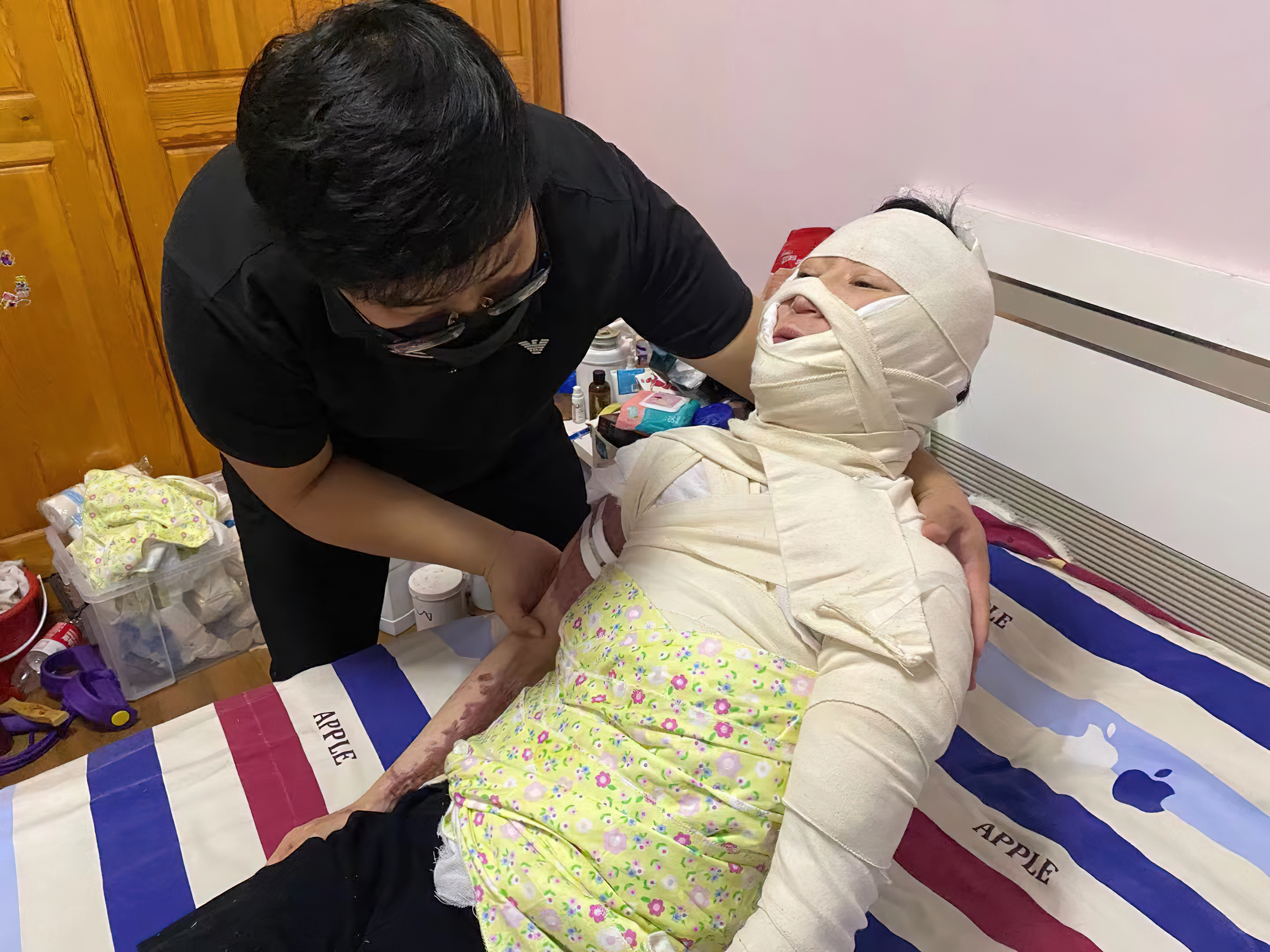 美女辣妈拔火罐烧伤如戴紧箍咒,美妈凌晨拔火罐烧伤