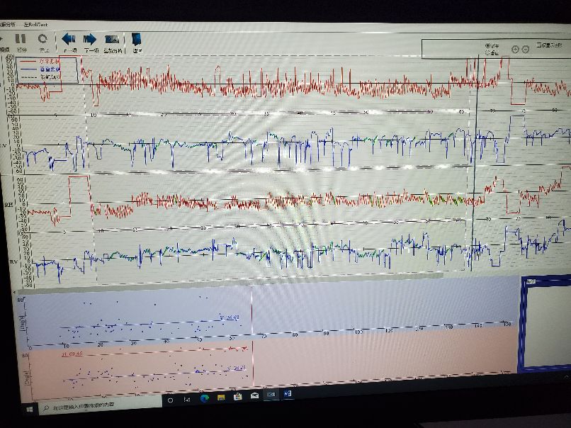 老年人颈椎病引起头晕恶心呕吐,头晕恶心干呕是不是颈椎病