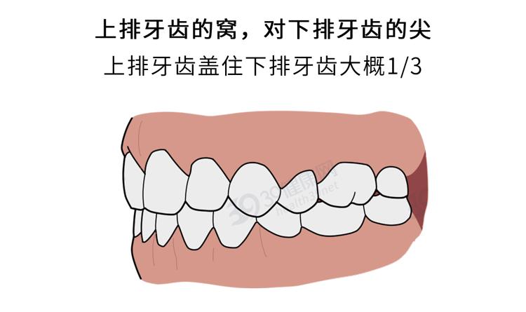 隐形牙套能矫正整齐吗,为什么戴牙套会让人变好看