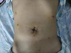 龙华区中心医院多学科协作成功救治水电解质、酸碱平衡紊乱患者