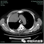 平台型的变化是什么,平台功能有什么新的变化