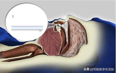 我打鼾鼾声如雷怎么治疗,打鼾声如雷咋治