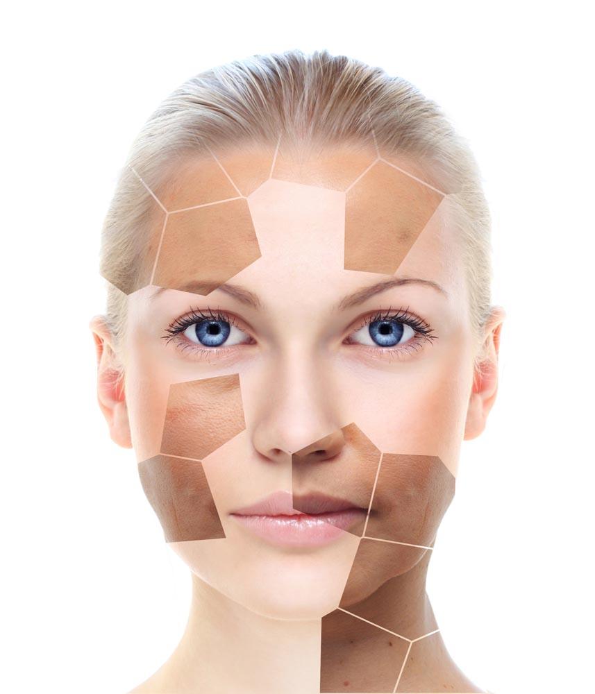 褐黄病是什么原因引起的,褐青色斑产生的原因