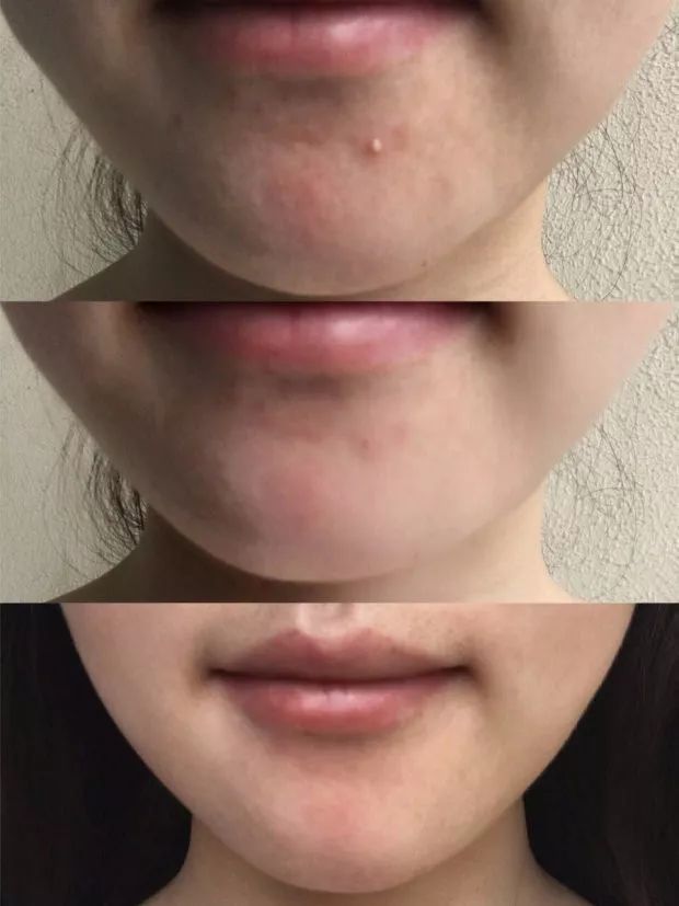 医美同康黄金面膜真的假的,医美面膜真的特别好吗