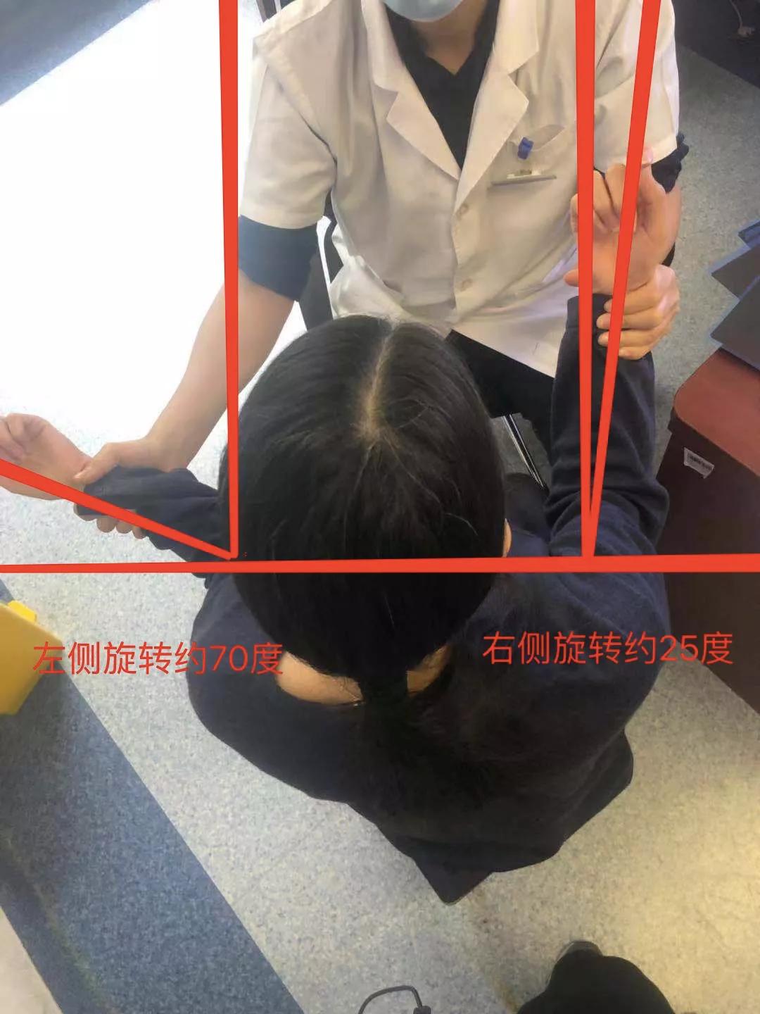 肩周炎锻炼过度会加重吗,肩周炎需要注意哪些问题