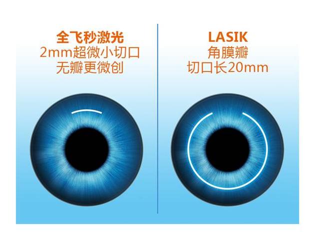 近视眼手术晶体移植和激光的区别,近视眼做了激光有什么利弊