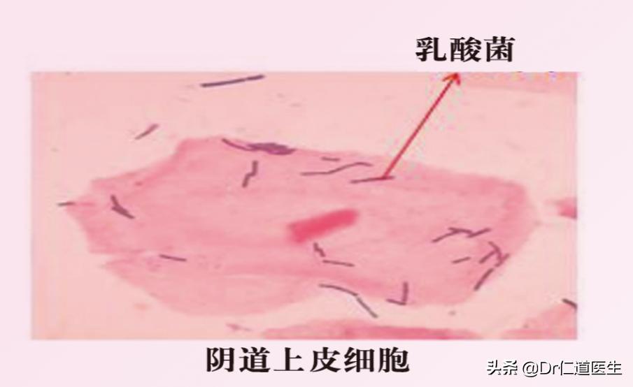 女性为何经常染上霉菌？都和这些“不检点”的行为有关，抓紧改掉