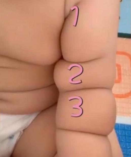 “捕蝇器宝宝”火了,用肉就能夹死苍蝇,妈妈晒视频被吐槽:心大