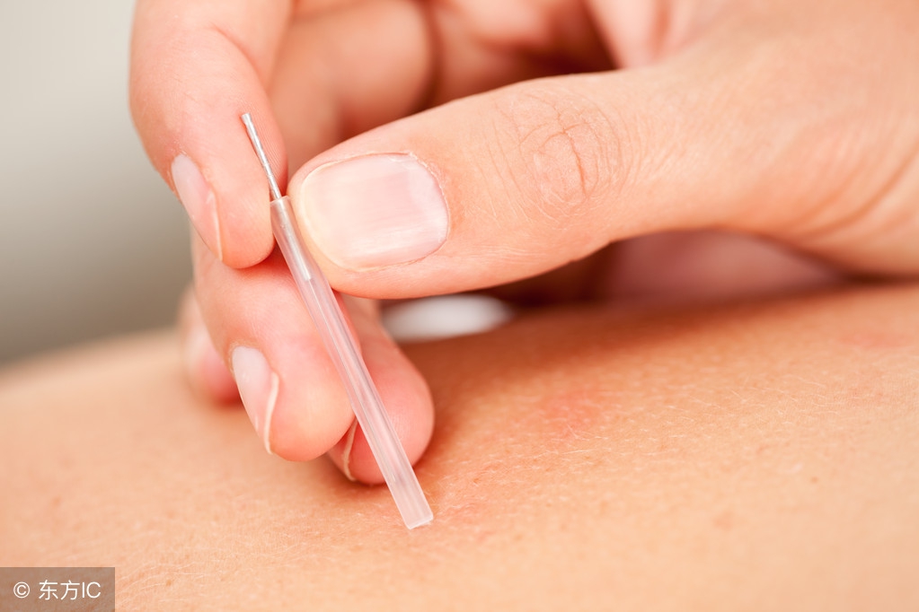 颈椎针灸的最佳时间和禁忌,针灸推拿拔罐的禁忌是什么