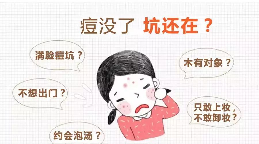 手把手教你正确挤痘不留坑,挤痘有个坑怎么补救