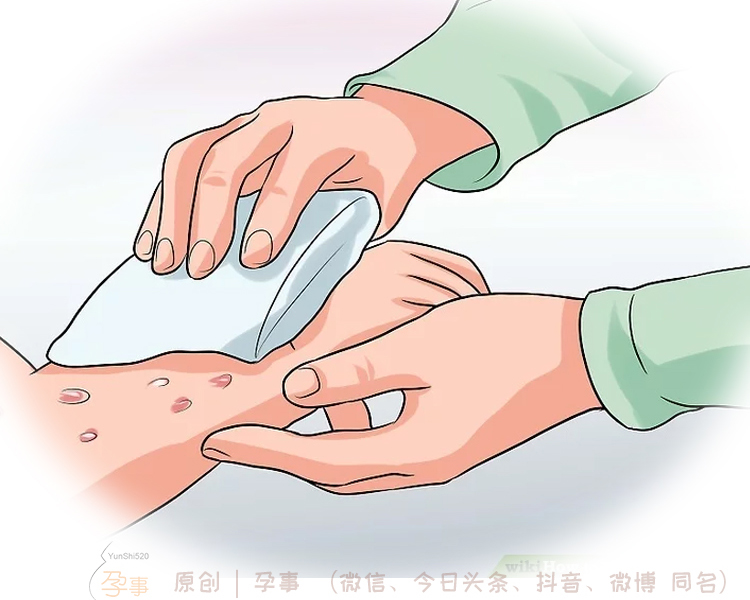 宝宝夏天起痱子最有效的解决方法,宝宝长了痱子用什么方法最有效