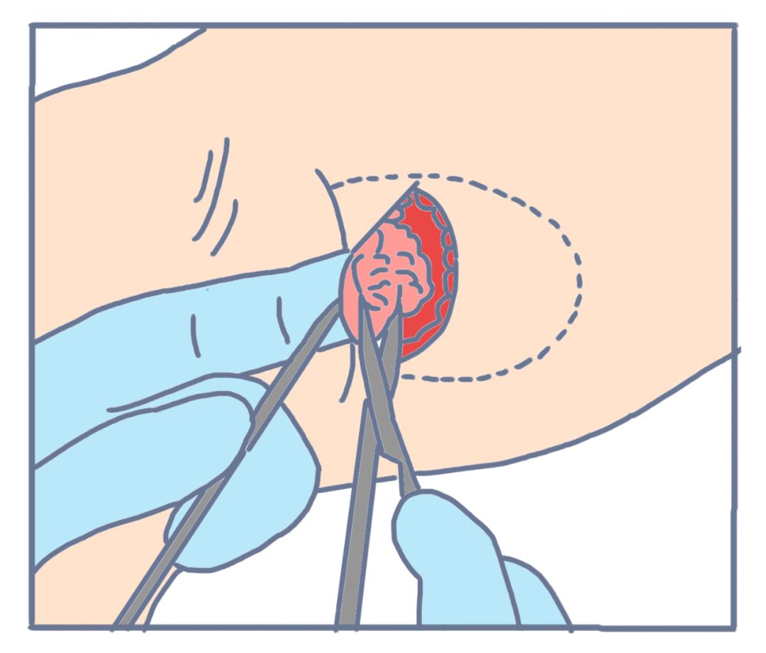 舍友狐臭大怎么办,舍友有狐臭受不了该怎么办