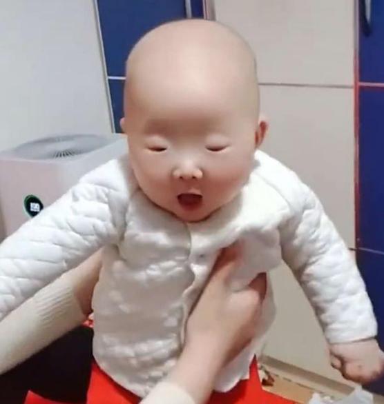 宝宝眼大眼小,宝宝眼睛小还能变成大双眼吗