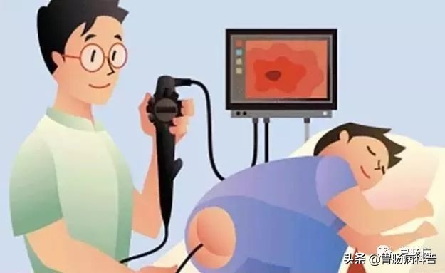 直肠神经内分泌瘤g2是类癌吗,直肠神经内分泌瘤叫类癌吗