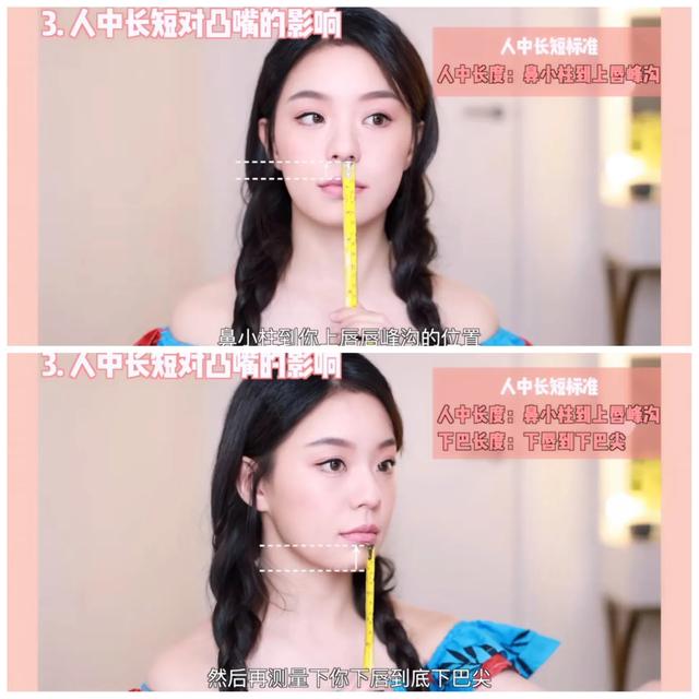 侧颜凸嘴怎么修,让侧脸变好看的方法